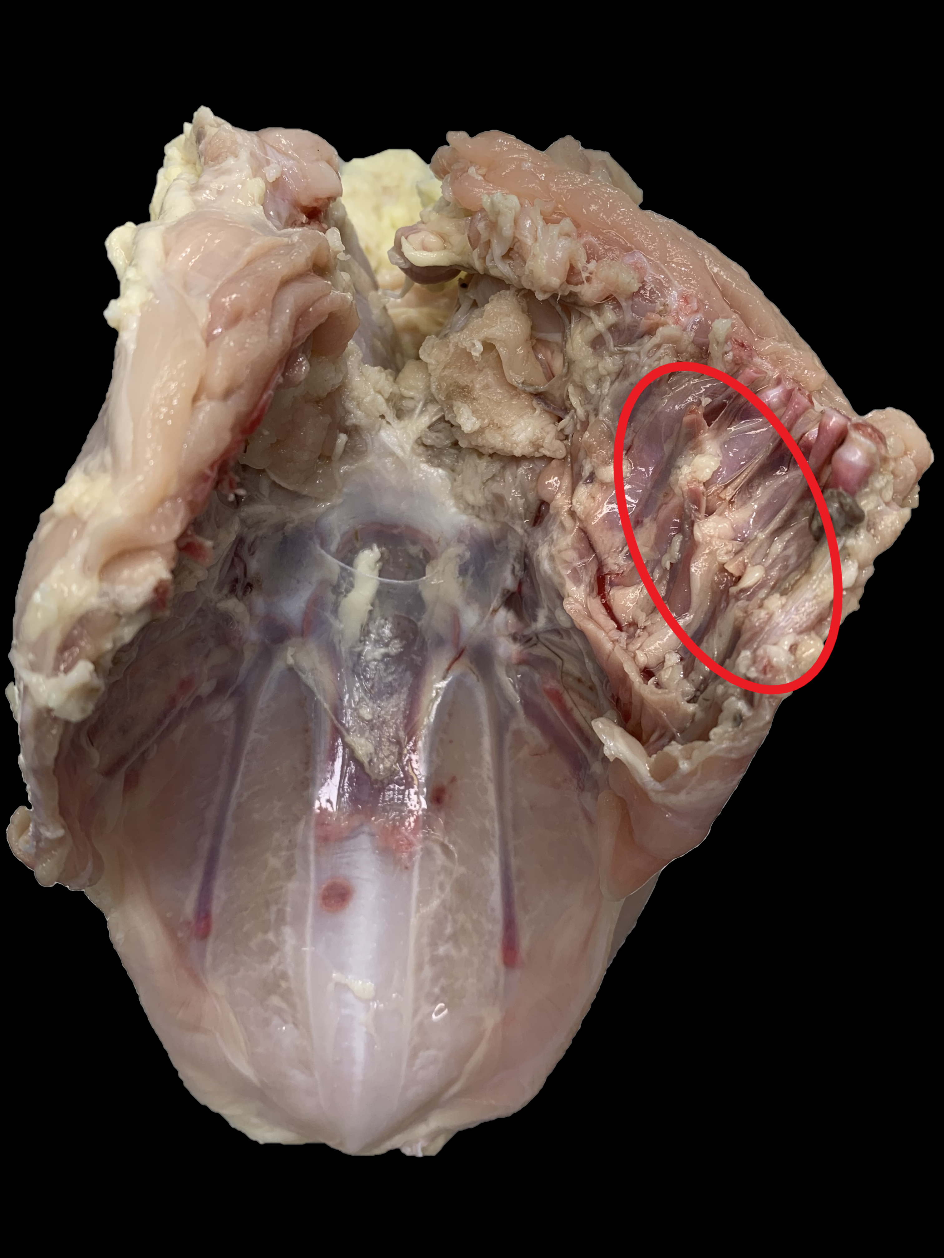 Grade C Whole Breast with Splintered Ribs (Inside)